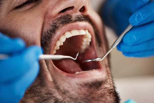 Best Broken or Cracked Tooth Emergency Dentist in Lockland, OH