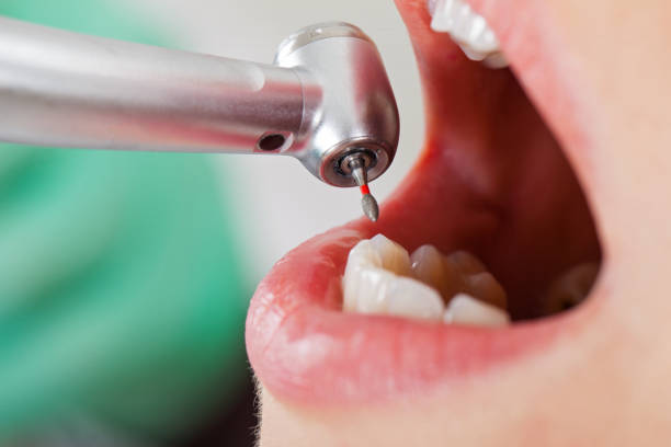 Best Emergency Dentist for Knocked-Out Tooth in Lockland, OH